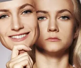 مراقبتهای افراد دو قطبی و شیدایی