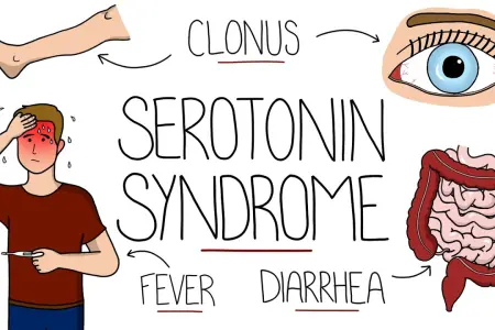 سندرم سروتونین