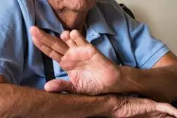 اختلال هویت تمامیت بدن