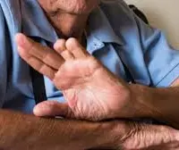 اختلال هویت تمامیت بدن